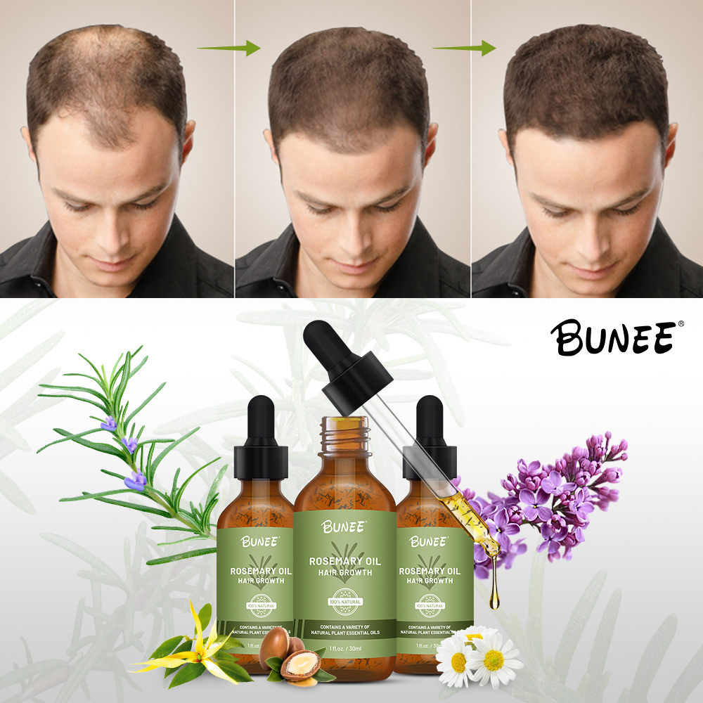 Anti-Loss Product Hair Growth Natural Ginger Oil Rosemary Leaf Vitamin E Hair Oil Treatment Care Serum Treatment