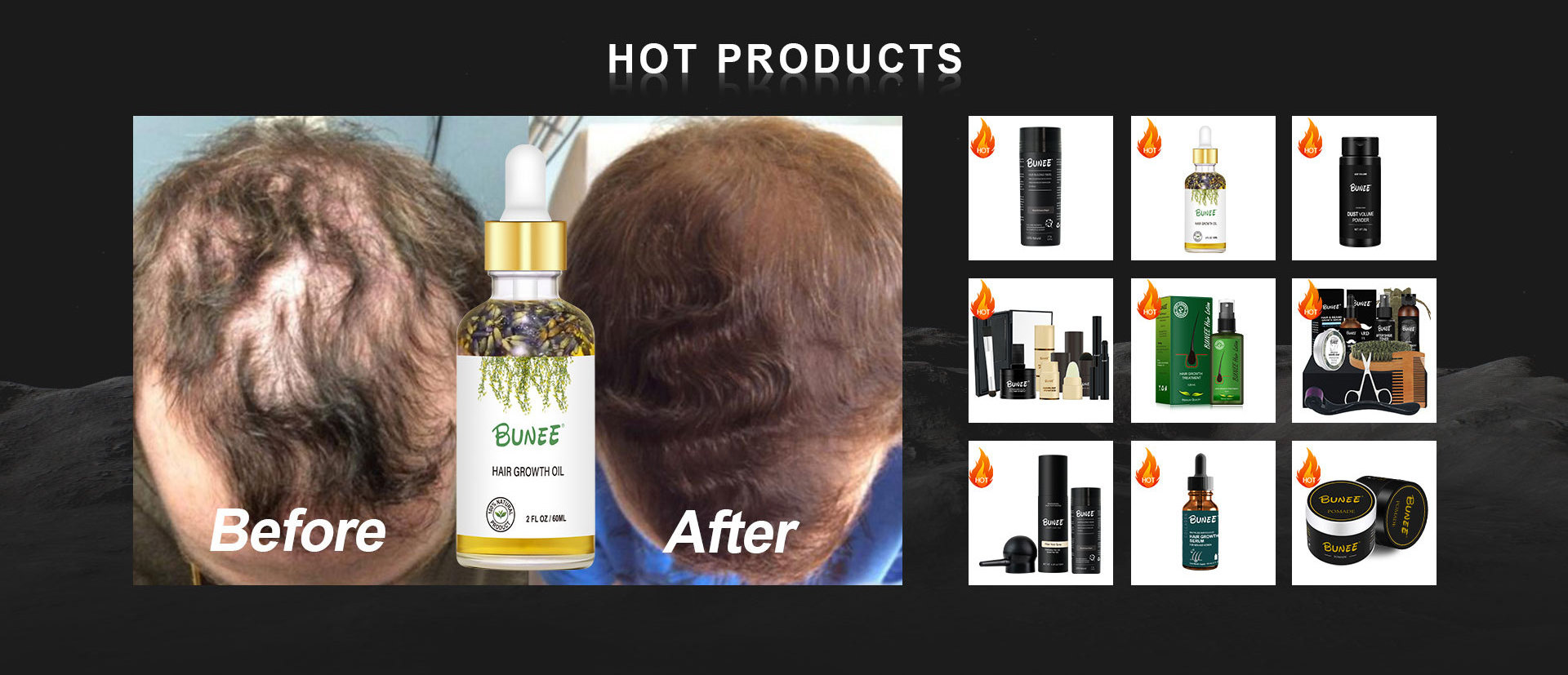 Anti-Loss Product Hair Growth Natural Ginger Oil Rosemary Leaf Vitamin E Hair Oil Treatment Care Serum Treatment