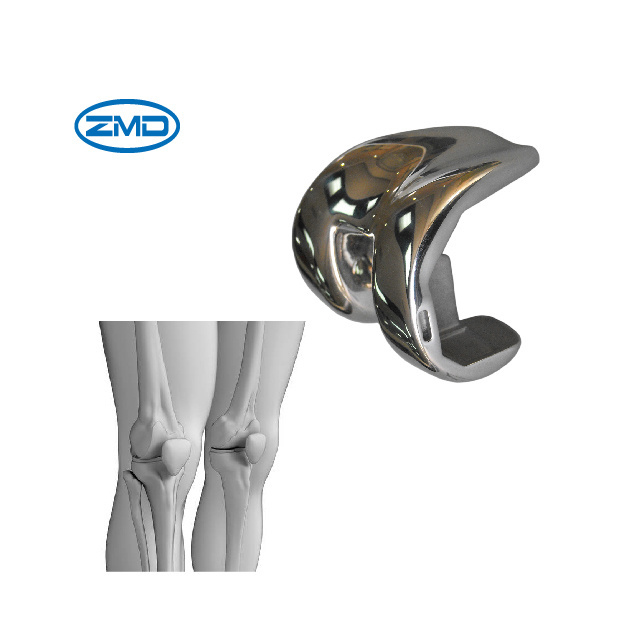 SKII Femoral Condyle (CR) ottobock prosthetic knee joint prosthetic knee joint component joints