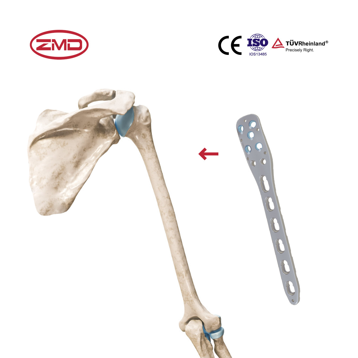 New Model Orthopedic Combination Holes Bone For Implant Multi-Axial Humeral Proximal Locking Plate