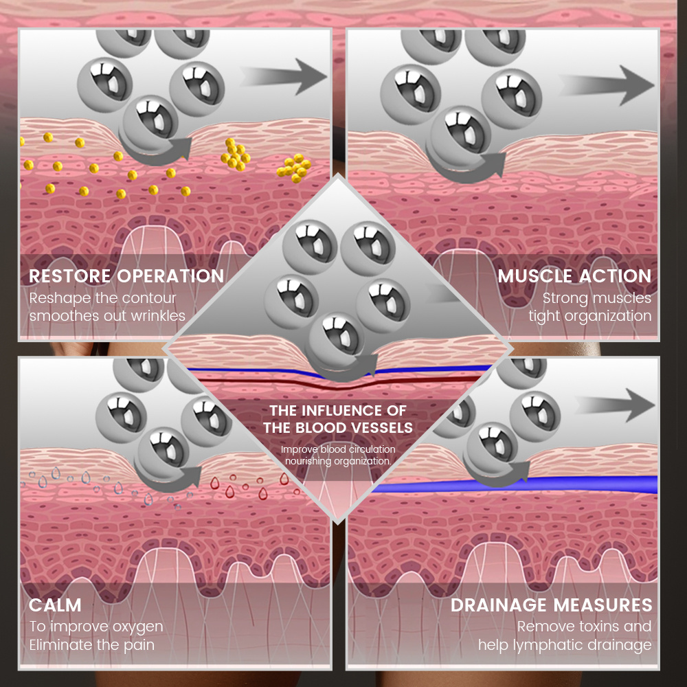Anti Cellulite Reduction Treatment Inner Ball Roller Machine Body Contouring pressotherapy lymphatic drainage machine