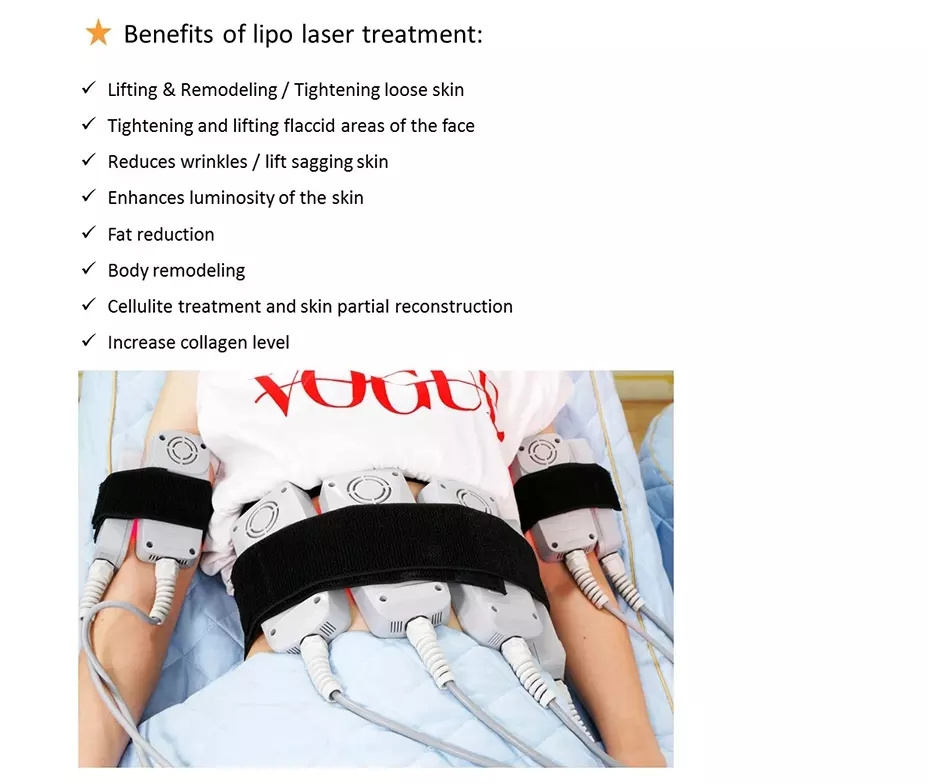 2022 Best Lipolaser 5D Body Slimming Cellulite Laser Slim Lipo Lipolysis Machine on Sale lipolaser machine