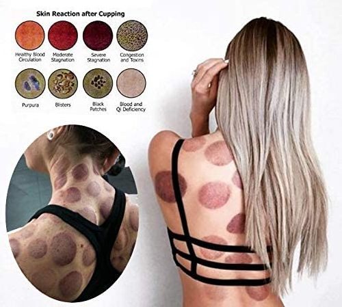 Chinese Medicine Cupping Therapy Sets,12Cups Hijama Cupping Set with Pump Vacuum Suction Cups for Body Cellulite Cupping