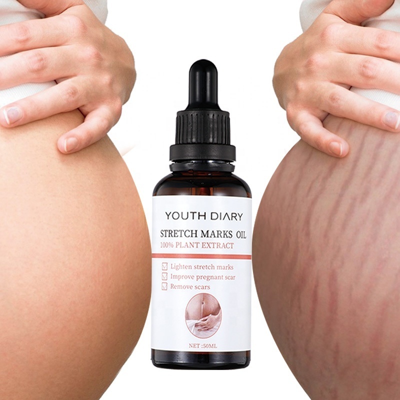 youth dairy stretch marks essential oils cream scar oil 100% natural pure  plant extract 7 days stretch mark removal oil