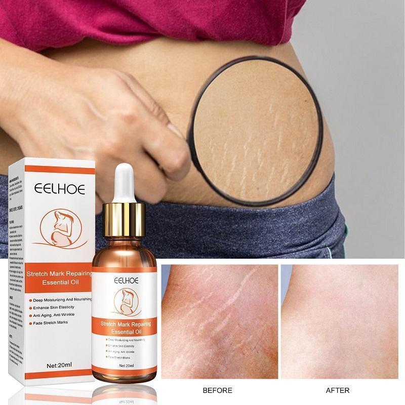 Wholesale Private Label Natural Return Smooth On Skin Anti Stretch Marks Anti Scar 100% Organic bio Stretch Mark Removal oil