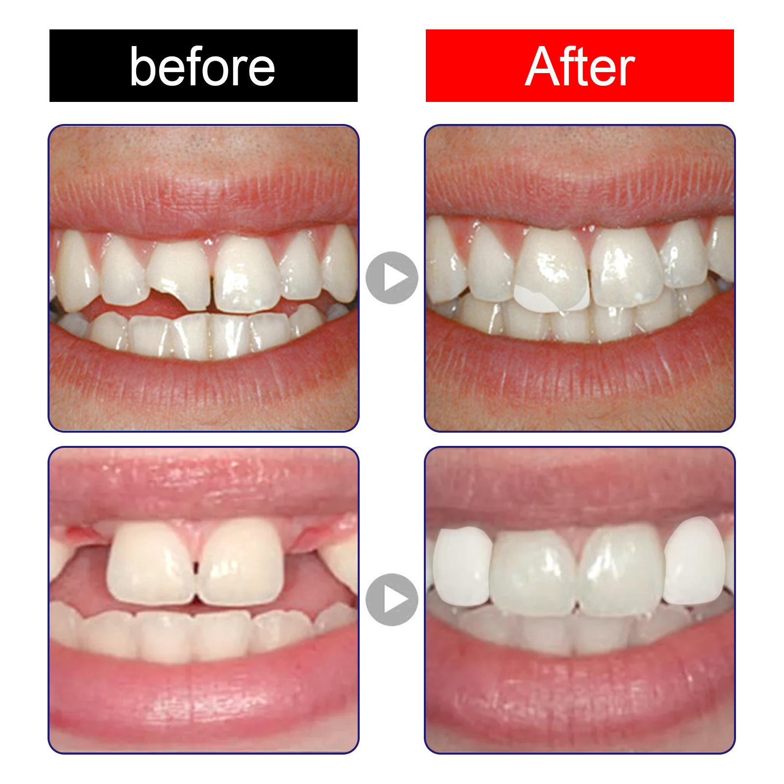 Plastic Resin Denture Adhesive Tooth Gap Repair Falseteeth Temporary Solid Glue Granules Moldable Tooth Care Makeup GG