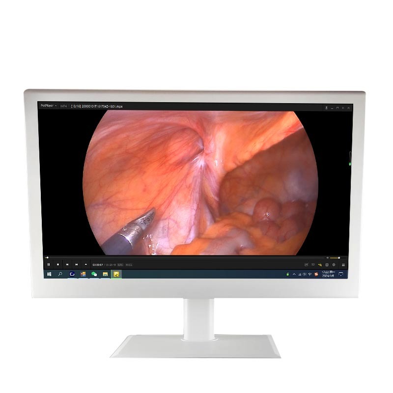 medical grade monitor ENT 24/27/32/55inch display 1080p 4K for endoscope camera