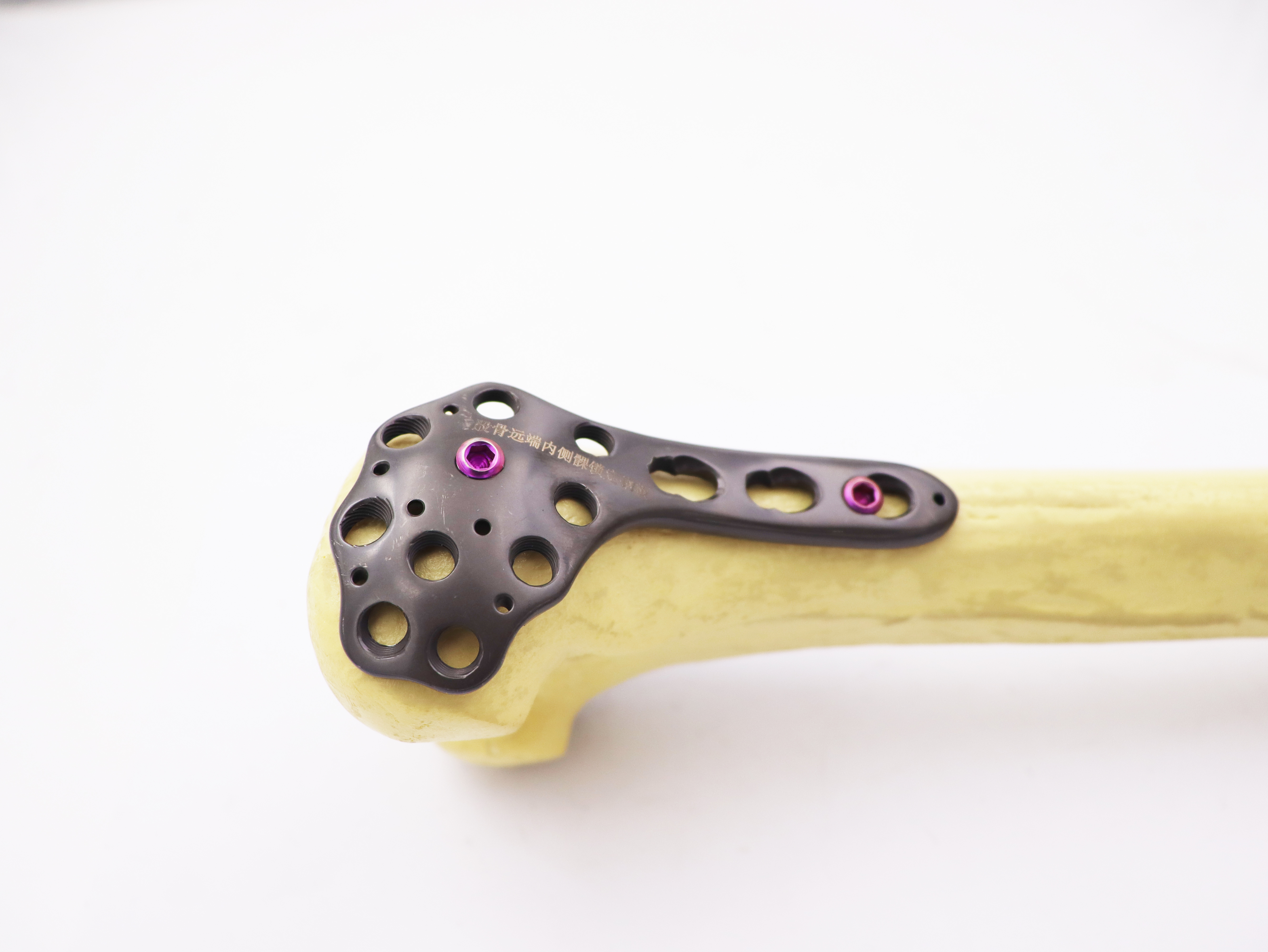 High Quality Orthopedic Implants Distal Femur Lateral Condyle Locking Compression Plate with CE Certificate