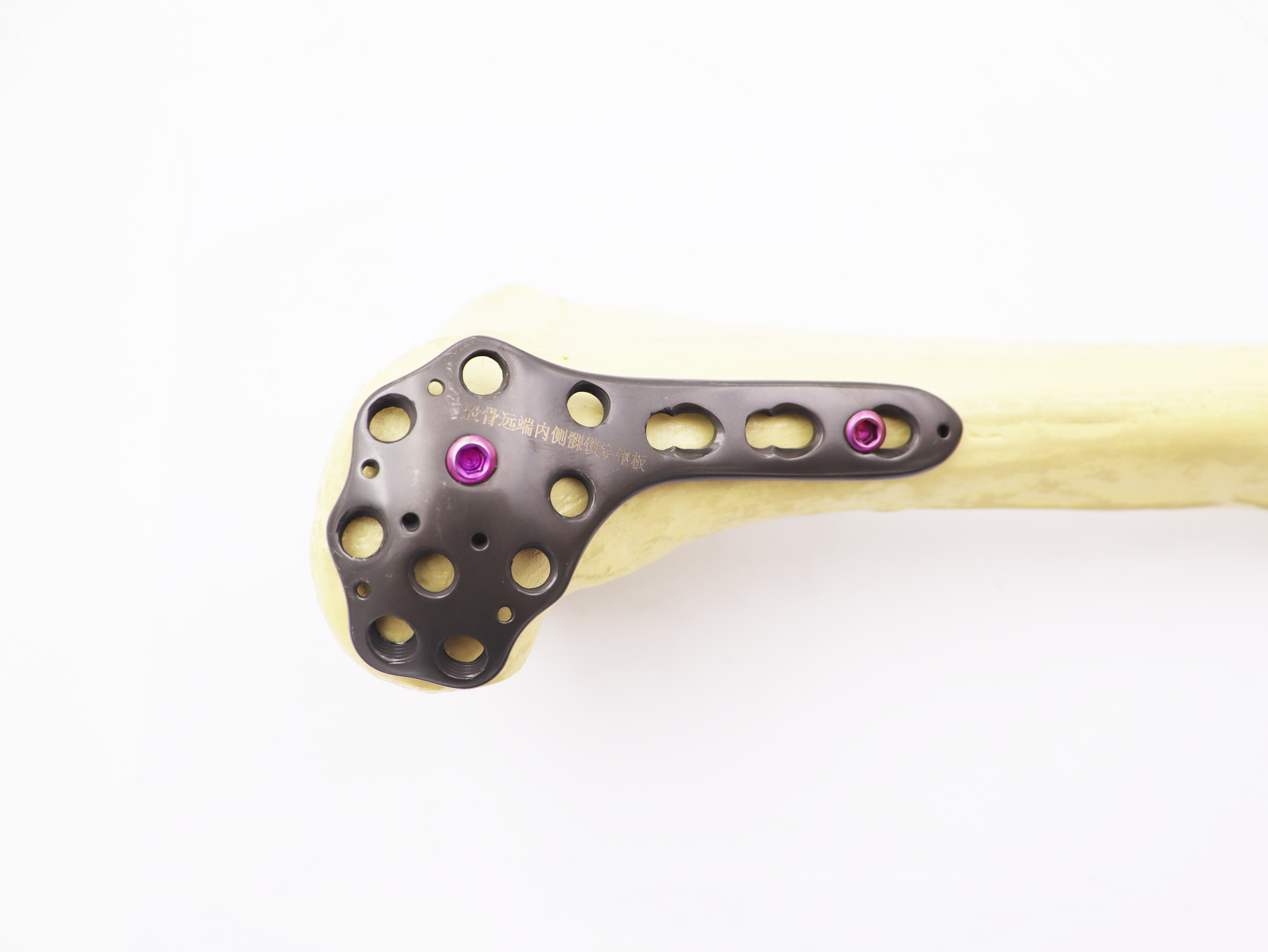 Orthopedic implant Distal Femur Lateral Condyle Locking Plate large fragment locking plate with Pure Titanium(L/R)