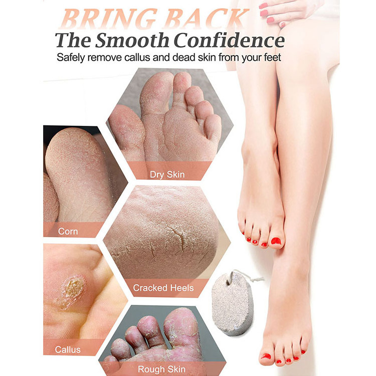 Hot Sales Foot Scrubber Pedicure Exfoliation Tool Natural Earth Lava Pumice Stone Cracked Heels Foot File