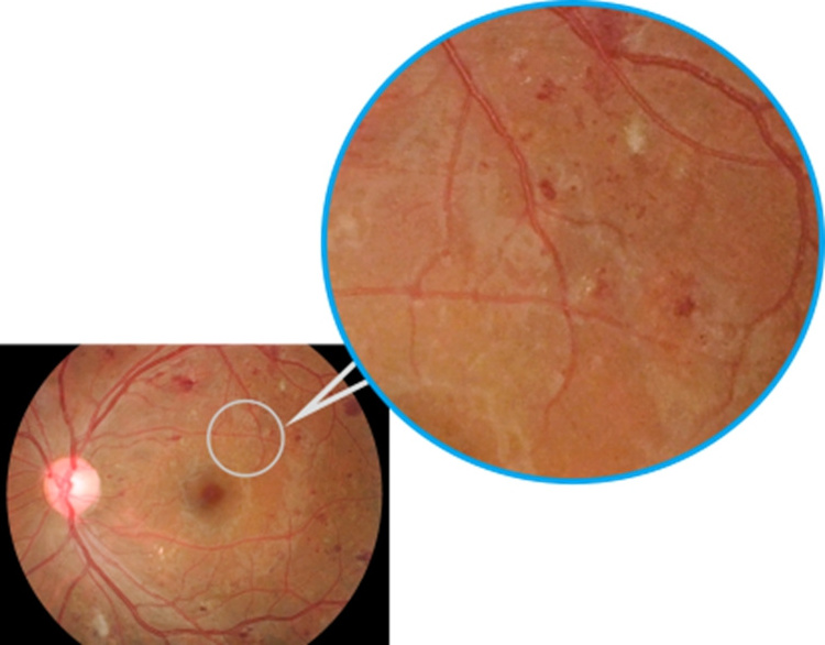 Top Quality Aps-Aer Non Mydriatic Eye Fundus Camera For Ophthalmology