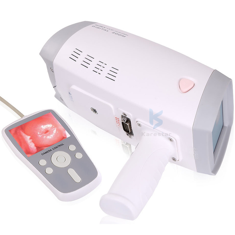 K-L10 Full Digital Handheld Video Vagina Colposcope