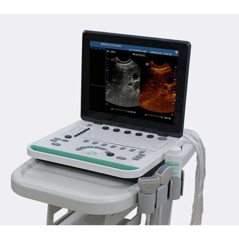 M7 Mindray Professional Portable 3D/4D Color Doppler Ultrasound Machine K-H501 ecografo mindray m5 m7 m9