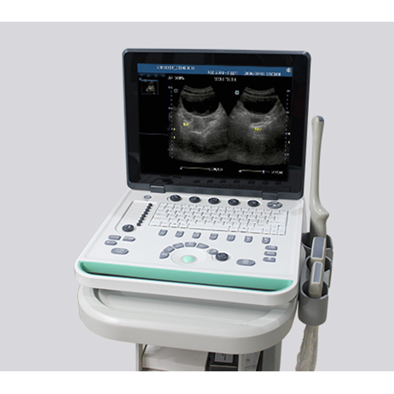 M7 Mindray Professional Portable 3D/4D Color Doppler Ultrasound Machine K-H501 ecografo mindray m5 m7 m9