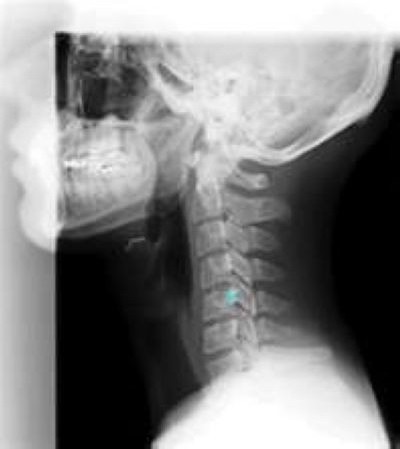 medical x ray film for ct scan machine