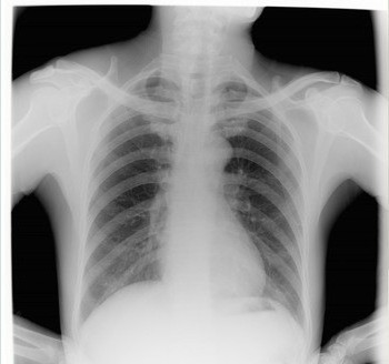 medical x ray film for ct scan machine