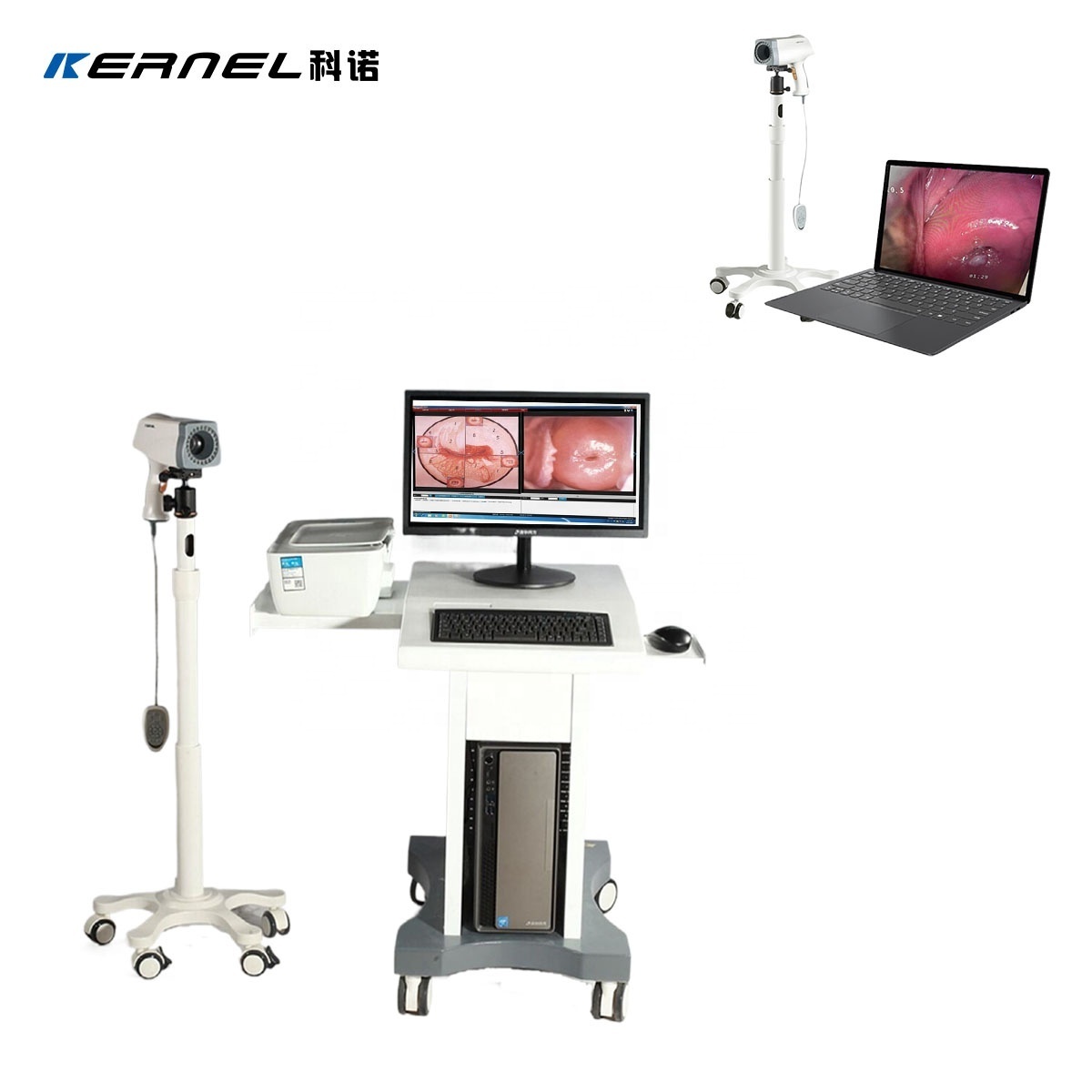 Kernel  KN-2200  Digital  Video Colposcope  Machine Vaginal Camera for cervical examination SD video camera colposcopy