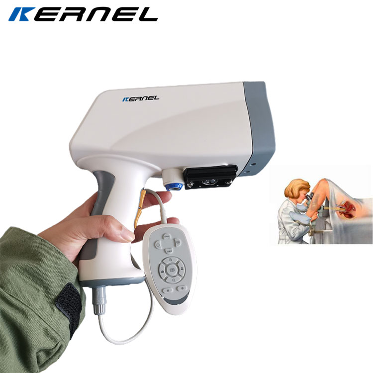 CE cleared gynocular Cervical Cancer Screening, video colposcope with spanish software vagina colposcopy camera KN-2200