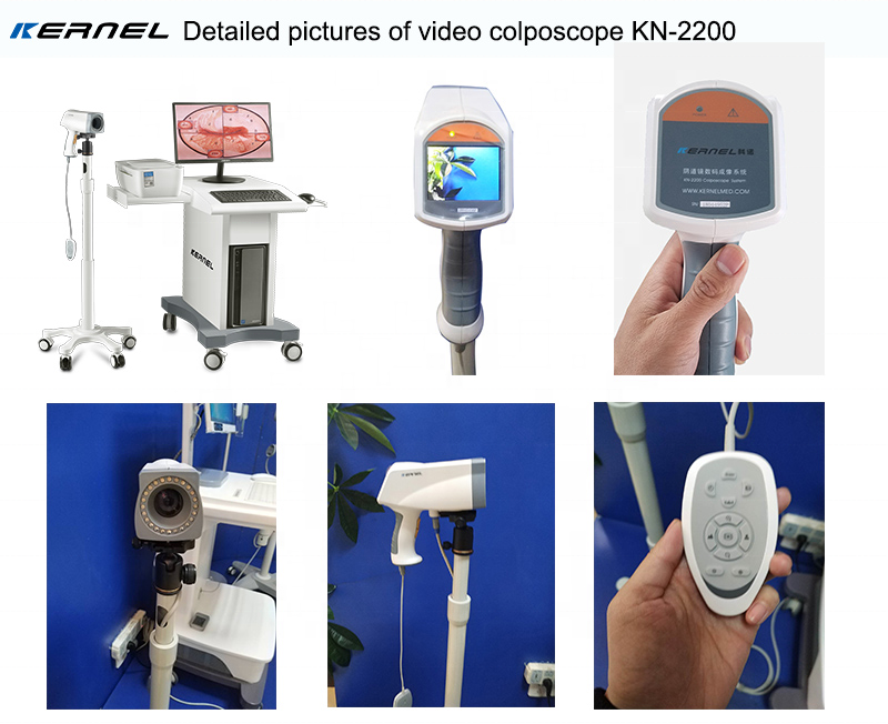 Kernel  KN-2200  Digital  Video Colposcope  Machine Vaginal Camera for cervical examination SD video camera colposcopy