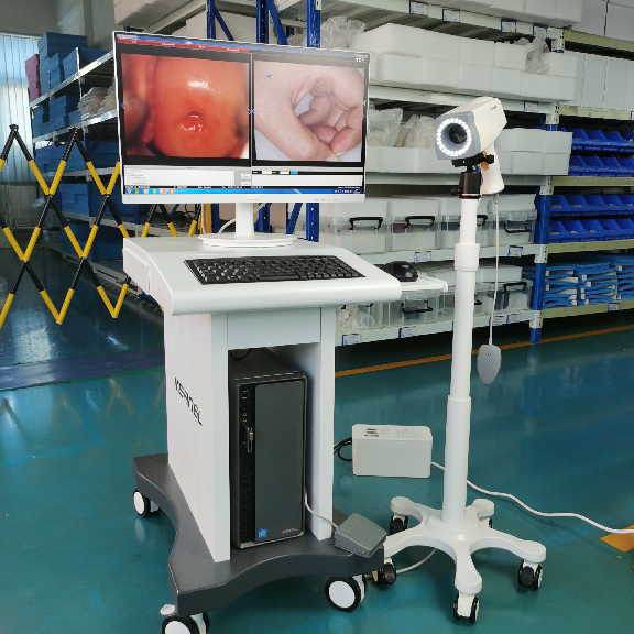 CE cleared gynocular Cervical Cancer Screening, video colposcope with spanish software vagina colposcopy camera KN-2200