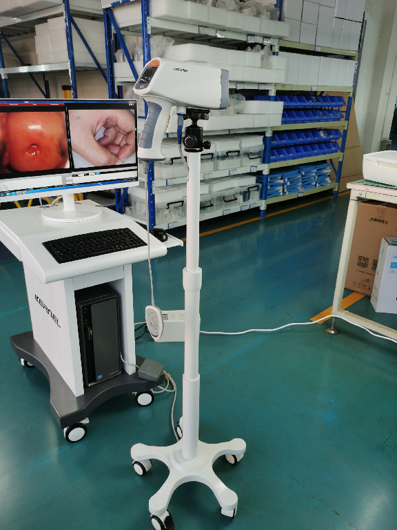 CE cleared gynocular Cervical Cancer Screening, video colposcope with spanish software vagina colposcopy camera KN-2200