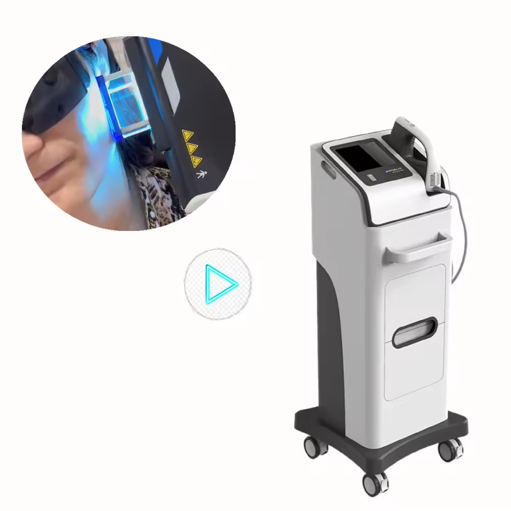 50mW/cm2 20CM2 Laser excimer vitiligo uvb treatment vitiligo laser treatment instrument