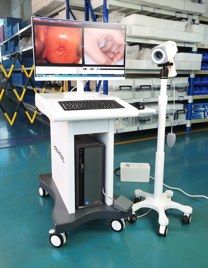 Kernel  KN-2200  Digital  Video Colposcope  Machine Vaginal Camera for cervical examination SD video camera colposcopy