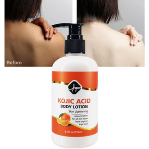 Wholesale Private Label Kojic Acid niacinamide Organic Dark Skin Brightening Whitening Body Lotion For Black Skin