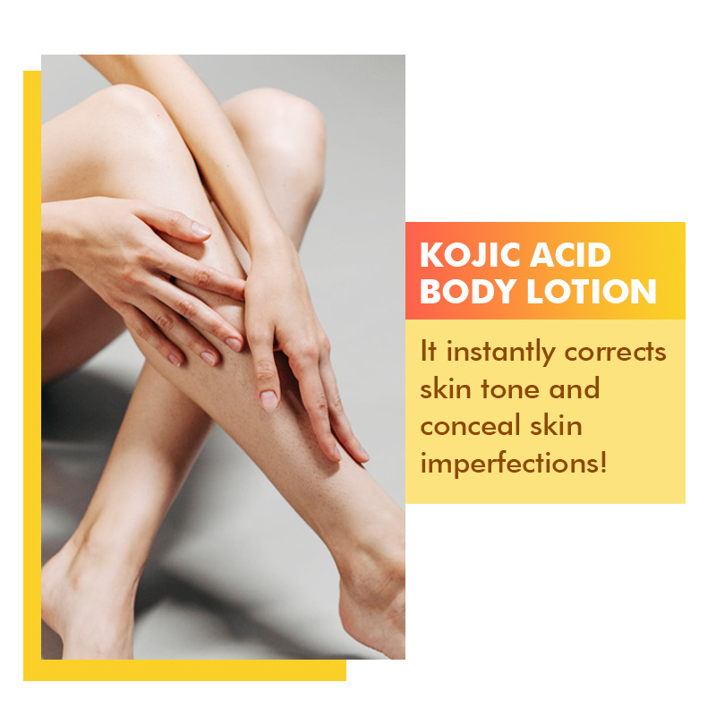 OEM kojic acid Natural organic niacinamide skin lightening whitening korean body lotion