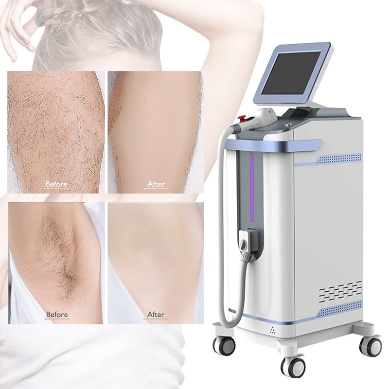 klaser  Professional 808nm Hair Removal  high power 1200W diode laser equipment for salon and SPA