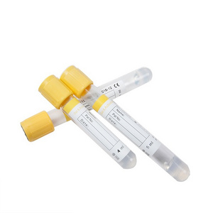 cheap good price yellow cap 5 ml gel blood test collection tubes