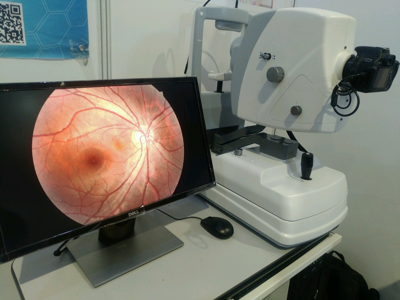 Non Mydriatic Eye Test Ophthalmic Equipment Digital Fundus Camera for Checking Fundus Lesions