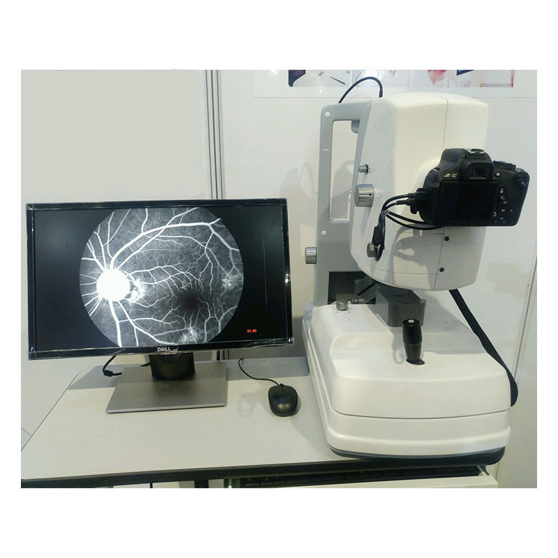 Top Quality Achieve Real-time Monitoring Non Mydriatic Eye Fundus Camera with Dual Screens