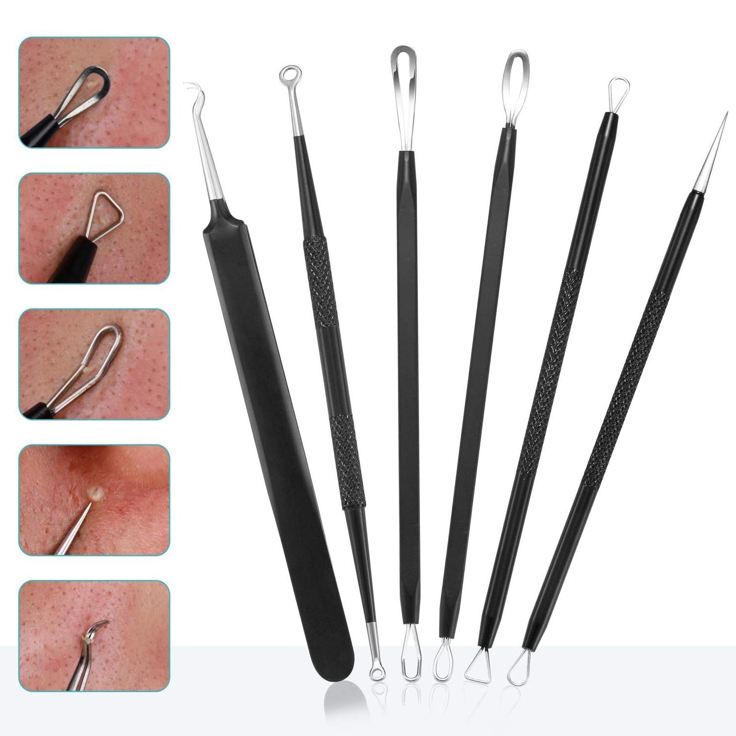 Blackhead Remover Pimple Popper Tool Kit Professional Stainless Pimples Comedone Extractor Removal Tool