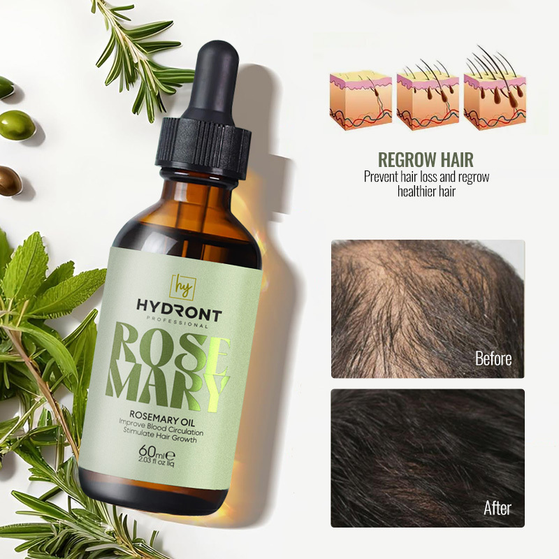 Best Selling Natural Organic Hair loss Treatment Rosemary Oil Hair Growth Scalp Massage Oil