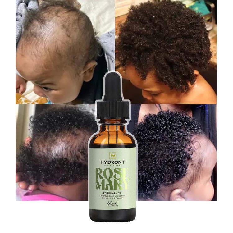 Best Selling Natural Organic Hair loss Treatment Rosemary Oil Hair Growth Scalp Massage Oil