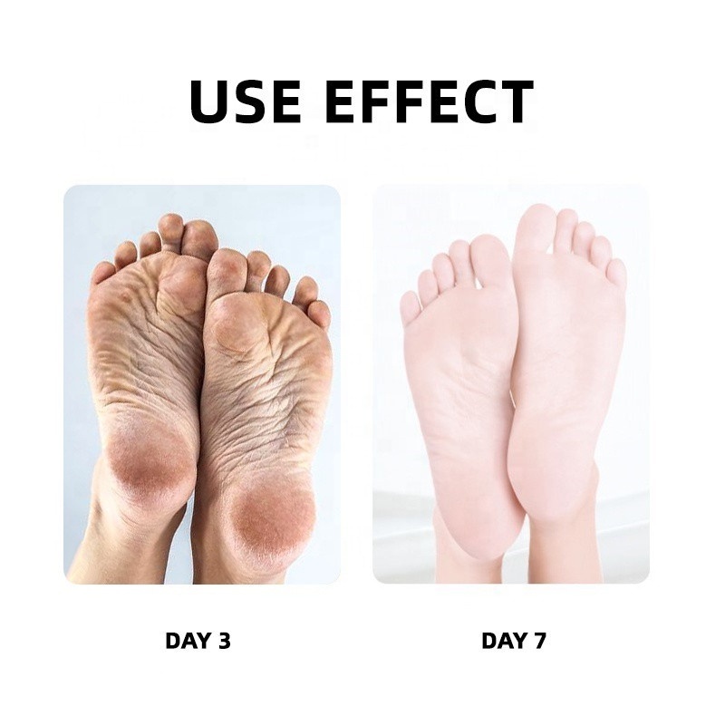 Pedicur Foot Spa Para Pedicure En Galones Supplies Professional Fungus Treatment Pedicure Essentialpedicure Foot Detox Soak Spa