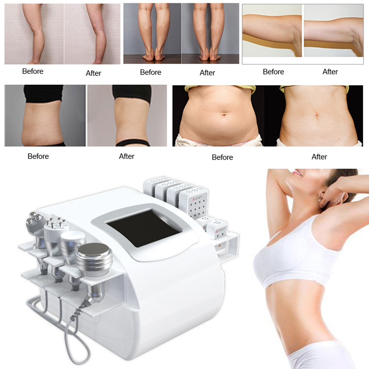 2024 Cheap Cavitation Machine 80k 40k Cavitation Rf Liposuction Machine Monopolar Cavitation Vacuum Machine