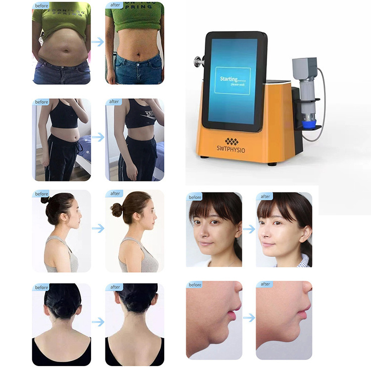 Shockwave Therapy Body Massager Machine Shockwave Machine For Pain Relief Human Shockwave Therapy Machine Home Use