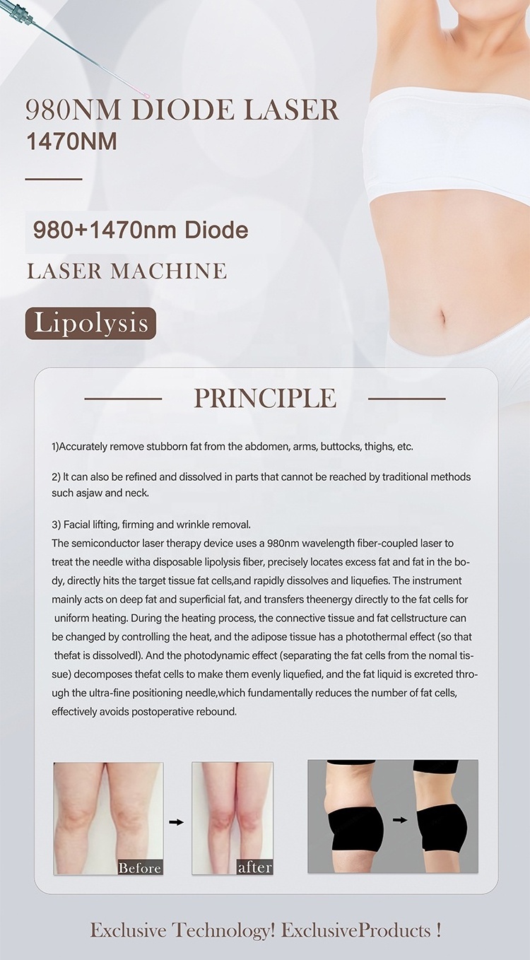 980nm 1470nm Laser Machine China 1470 980 Nm Diode Laser Liposuction Slimming Diode Laser 980 1470nm best fat removal for Clinic