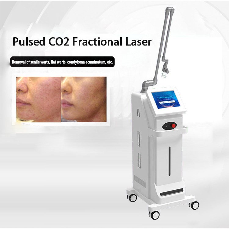 Dioxide Fractional Laser Carbon Dioxide Fractional Laser For Lightening Dark Spots With Remarkable Results And Simple Operation