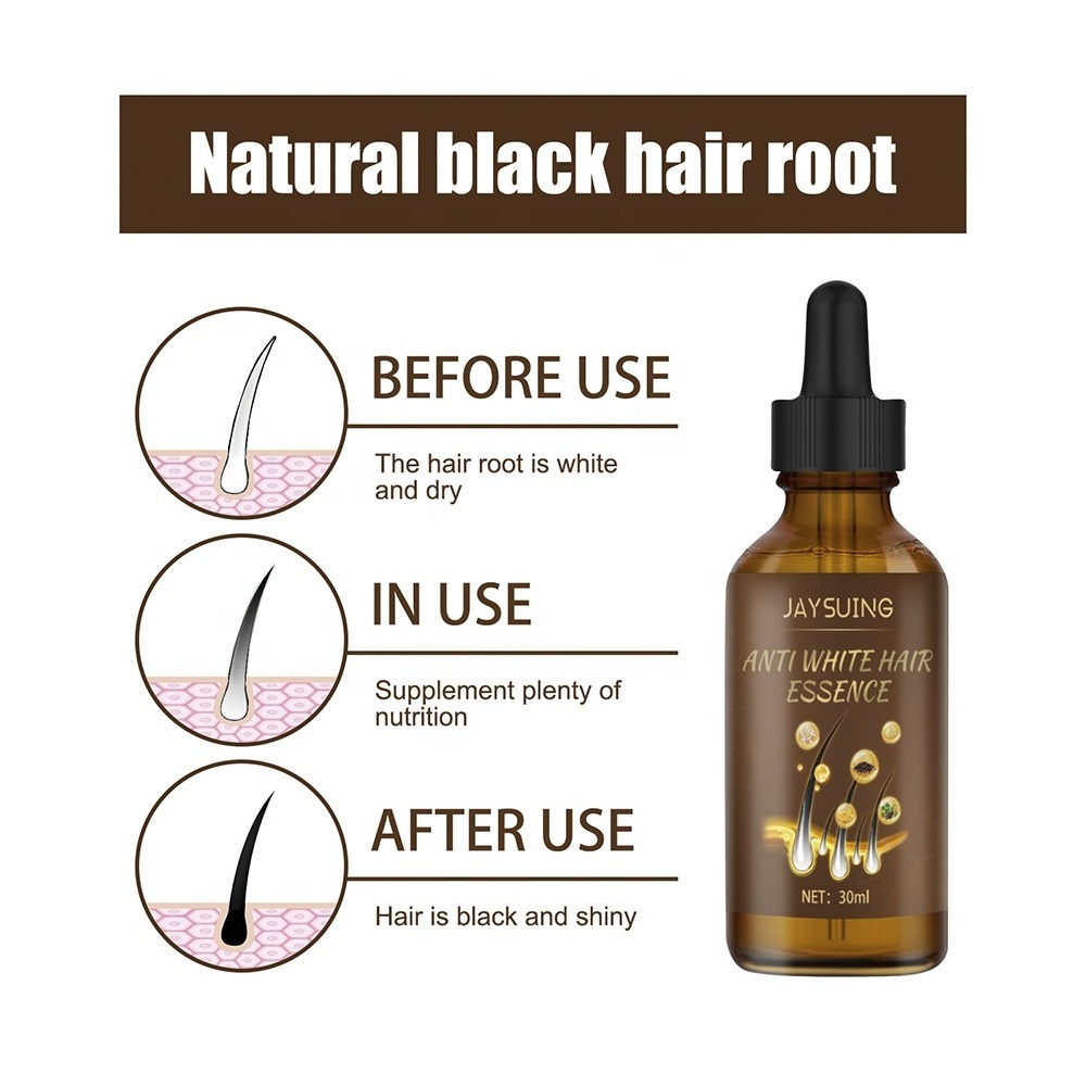 Laijiwan Anti-white Hair Essence White to Black Black hair Scalp massage moisturizing hair growth solution Oil