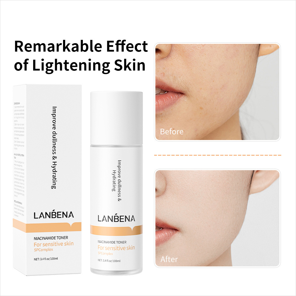 LANBENA Niacinamide vitamin c whitening facial water face toner 3D lightening to improve dullness deeply moisturizing