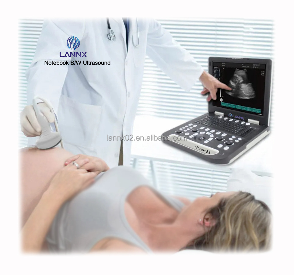 LANNX uRason E2 Manufacturer ultrasound diagnostic system clinic portable Digital Black and White echocardiography machine