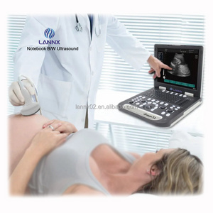 LANNX uRason E2 Manufacturer ultrasound diagnostic system clinic portable Digital Black and White echocardiography machine