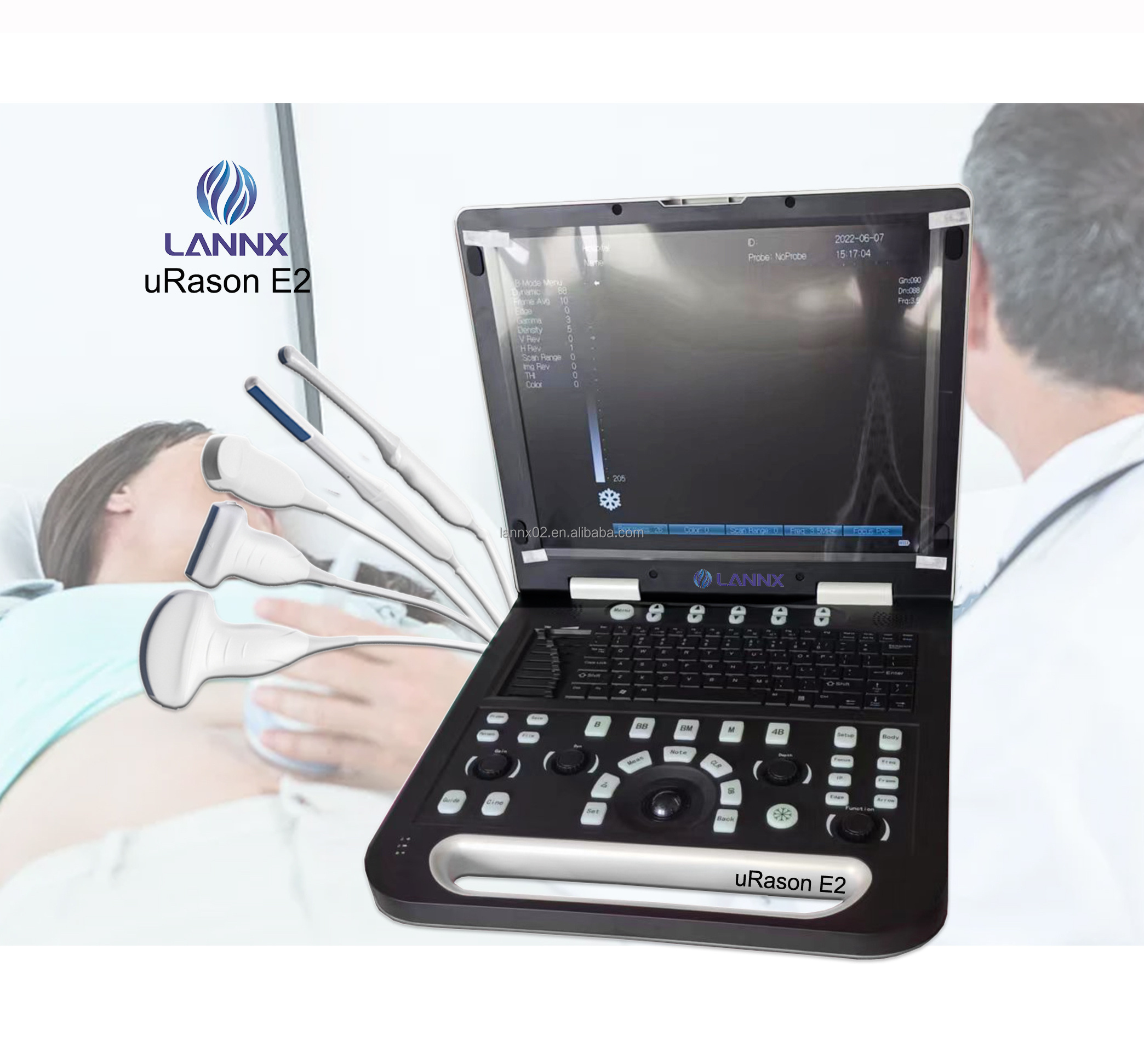 LANNX uRason E2 Very popular Hospital laptop echographe ecografo ultrasound instrument color ultrasonic digital portable usg