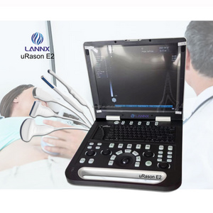 LANNX uRason E2 Very popular Hospital laptop echographe ecografo ultrasound instrument color ultrasonic digital portable usg