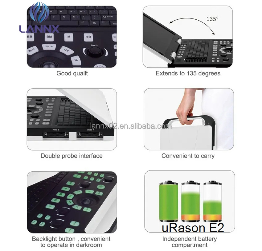 LANNX uRason E2 Very popular Hospital laptop echographe ecografo ultrasound instrument color ultrasonic digital portable usg