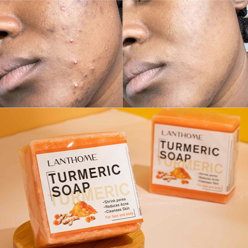 Wholesale Handmade Turmeric Shower Bath Soap Skin Whitening Lightening Anti Acne Deep Cleansing Bleaching Kojic Acid Face Soap