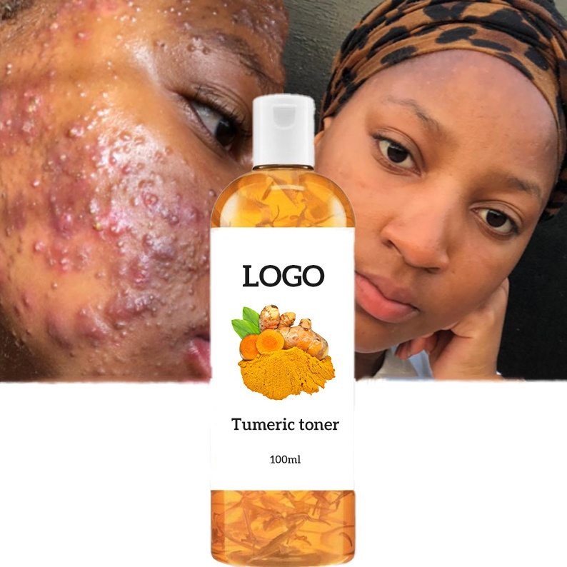 Private Label Turmeric Strong Lightening Facial Toner Moisturizing Whitening Brightening Acne Treatment Turmeric Face Toner